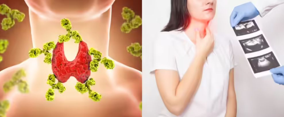 Symptoms that tell your thyroid gland has turned cancerous